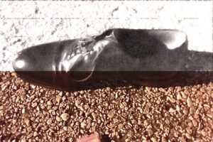 Hugs and Empty Ambulances